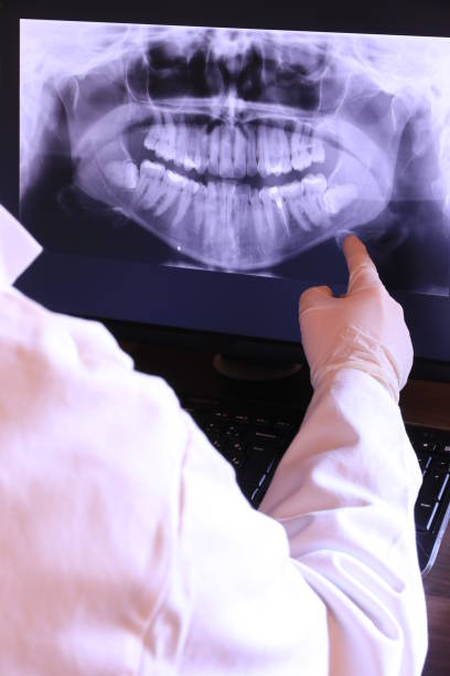 Best Knocked-Out Tooth (Avulsed Tooth) Treatment in Danville, IA