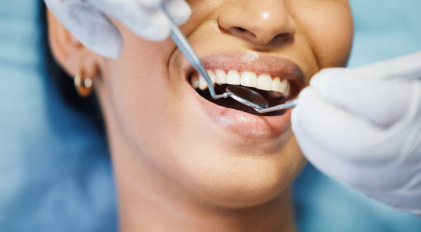 Best Emergency Wisdom Tooth Extraction in Danville, IA